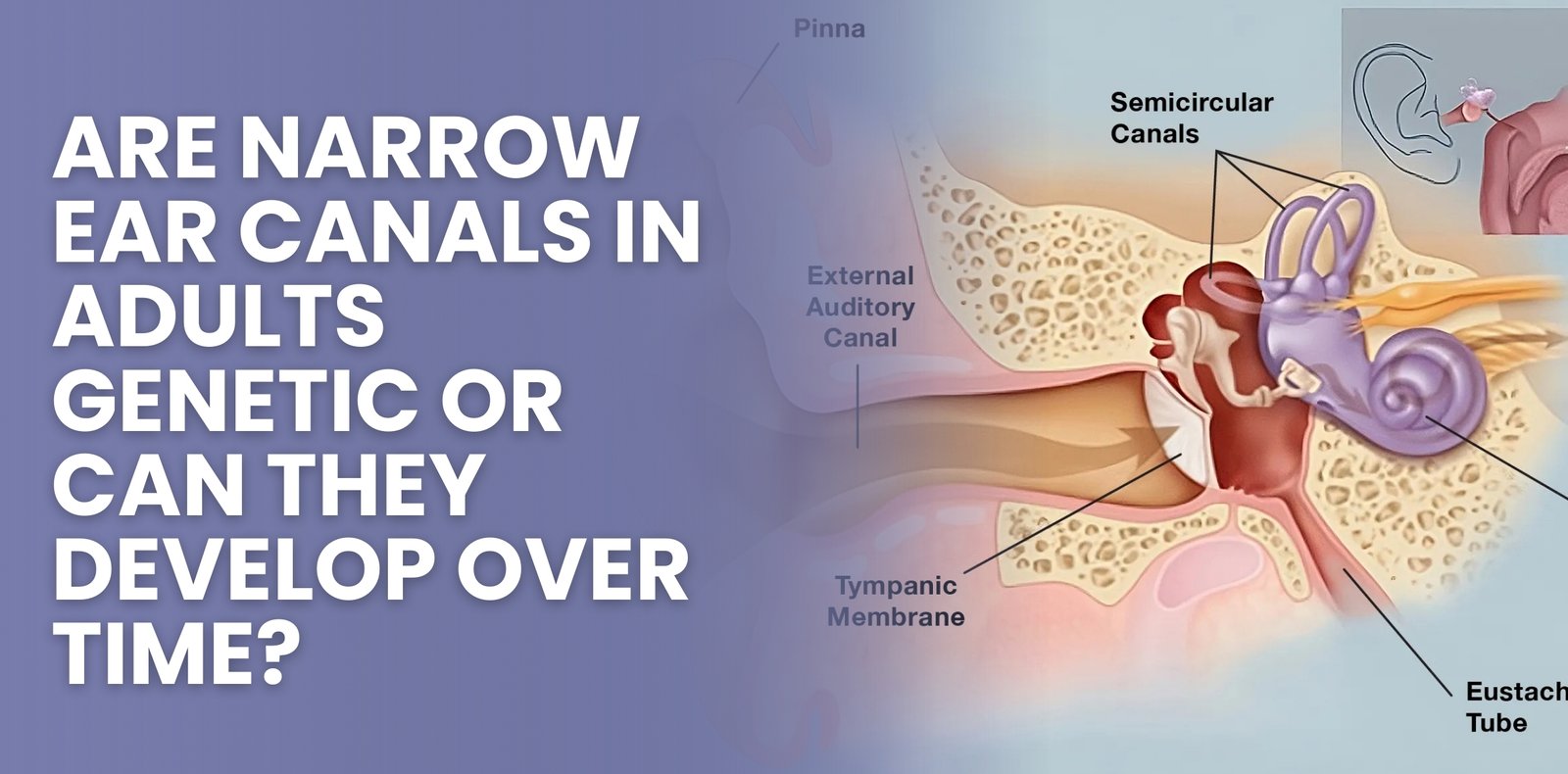 Are Narrow Ear Canals in Adults Genetic or Can They Develop Over Time?