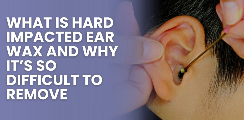 What Is Hard Impacted Ear Wax and Why It’s So Difficult to Remove