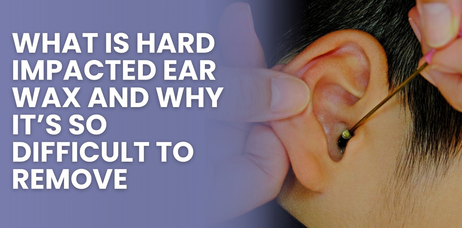 What Is Hard Impacted Ear Wax and Why It’s So Difficult to Remove